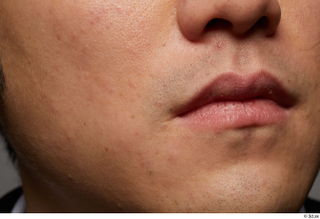 HD Face Skin Allvince Epps cheek chin face lips mouth…